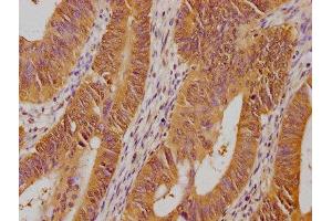 Immunohistochemistry (IHC) image for anti-Proteasome (Prosome, Macropain) 26S Subunit, Non-ATPase, 14 (PSMD14) (AA 264-283), (Regulatory Subunit 14) antibody (ABIN7139700)