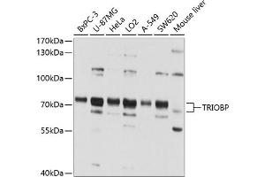 Western blot analysis of extracts of various cell lines, using TRIOBP antibody (ABIN1683149, ABIN3018979, ABIN3018980 and ABIN6220655) at 1:1000 dilution. (TRIOBP 抗体  (AA 180-310))