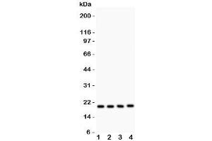 Western blot testing of DJ-1 antibody and human samples 1:  PANC;  2: U20S;  3: SMMC-7721;  4: HeLa lysate. (PARK7/DJ1 抗体  (AA 2-189))