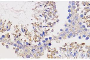 Immunohistochemistry of paraffin-embedded Mouse testis using Bcl-2 Polyclonal Antibody at dilution of 1:100 (40x lens). (Bcl-2 抗体)