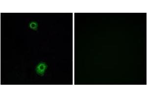 Immunofluorescence analysis of A549 cells, using HTR1B Antibody. (5HT1B Receptor 抗体  (AA 261-310))