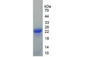SDS-PAGE (SDS) image for Afamin (AFM) ELISA Kit (ABIN6730921)