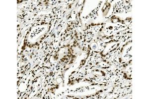 IHC analysis of KAP1/TRIM28 using anti-KAP1/TRIM28 antibody (ABIN7602310). (KAP1 抗体  (AA 699-835))