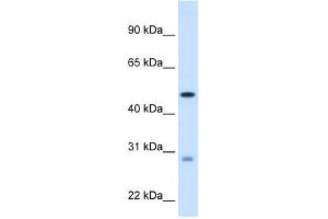 WB Suggested Anti-ECHS1 Antibody Titration:  1. (ECHS1 抗体  (C-Term))