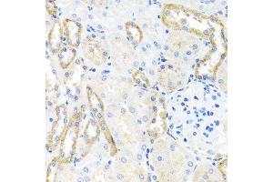 Immunohistochemistry of paraffin-embedded rat kidney using BSND antibody. (BSND 抗体  (AA 54-320))