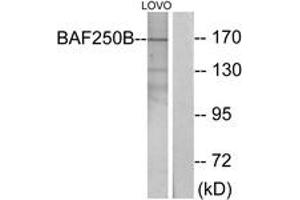 Western Blotting (WB) image for anti-AT Rich Interactive Domain 1B (SWI1-Like) (ARID1B) (AA 1371-1420) antibody (ABIN2889682) (ARID1B 抗体  (AA 1371-1420))