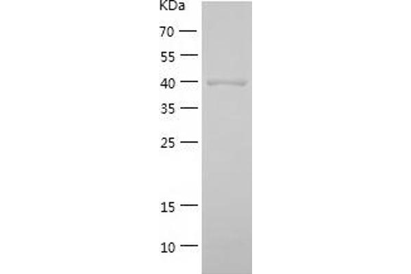 ADH6 Protein (AA 1-375) (His tag)