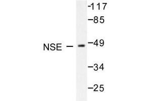 Image no. 1 for anti-Enolase 2 (Gamma, Neuronal) (ENO2) antibody (ABIN271752) (ENO2/NSE 抗体)
