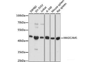 Western blot analysis of extracts of various cell lines using MADCAM1 Polyclonal Antibody at dilution of 1:1000. (MADCAM1 抗体)