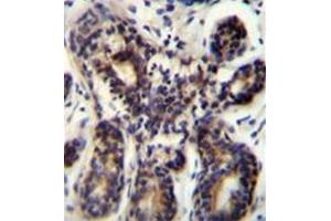 Immunohistochemistry analysis in formalin fixed and paraffin embedded human breast tissue reacted with AP52820PU-N, which was peroxidase conjugated to the secondary antibody and followed by DAB staining. (NBPF8 抗体  (N-Term))