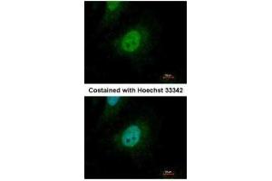 ICC/IF Image Immunofluorescence analysis of paraformaldehyde-fixed HeLa, using SMAD9, antibody at 1:500 dilution. (SMAD9 抗体)
