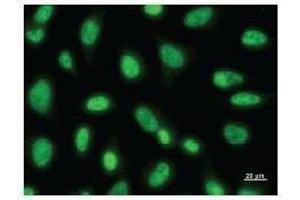 Immunofluorescence (IF) image for anti-Paired Box 6 (PAX6) antibody (ABIN930925)