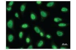 Immunostaining analysis in HeLa cells. (PAX6 抗体)
