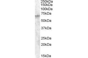 ABIN238651 (1µg/ml) staining of HepG2 cell lysate (35µg protein in RIPA buffer). (IGF2BP2 抗体  (C-Term))