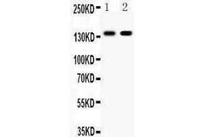 Observed bind size: 140KD (E-cadherin 抗体  (AA 286-703))