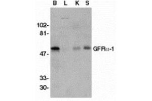 Western blot analysis of GFR alpha 1 in crude membrane fractions of human brain (B), liver (L), kidney (K), and spleen (S), respectively, with AP30361PU-N GFR alpha 1 antibody at 1/500 dilution. (GFRA1 抗体  (Intermediate Domain))