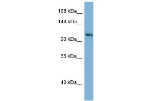 Host: Rabbit Target Name: TSC22D1 Antibody Dilution: 1. (TSC22D1 抗体  (C-Term))