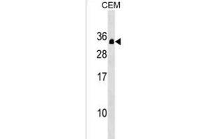 PDCD10 Antibody (Center) (ABIN1538712 and ABIN2849495) western blot analysis in CEM cell line lysates (35 μg/lane). (PDCD10 抗体  (AA 96-124))