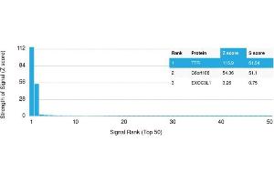 Analysis of Protein Array containing more than 19,000 full-length human proteins using Transthyretin (Prealbumin) Mouse Monoclonal Antibody (CPTC-TTR-1). (TTR 抗体)