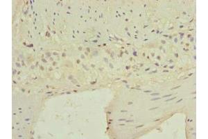 Immunohistochemistry of paraffin-embedded human small intestine tissue using ABIN7145326 at dilution of 1:100
