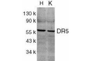 Western Blotting (WB) image for anti-Tumor Necrosis Factor Receptor Superfamily, Member 10b (TNFRSF10B) (AA 388-407) antibody (ABIN2479551) (TNFRSF10B 抗体  (AA 388-407))