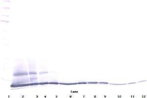 Western Blot (Reduced) using ESkine / CCL27 antibody