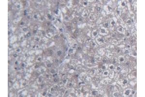 DAB staining on IHC-P; Samples: Human Liver Tissue (Urocortin 2 抗体  (AA 20-112))