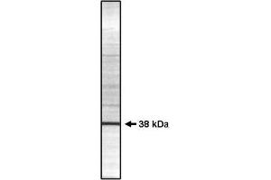 Image no. 1 for anti-Protein Phosphatase 1, Catalytic Subunit, gamma Isoform (PPP1CC) (Isoform gamma 2) antibody (ABIN264937)