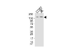 Western blot analysis of extracts from COS7 cells (Lane 1), and JK cells (Lane 2), using PLCG1 (Ab-771) Antibody. (Phospholipase C gamma 1 抗体)