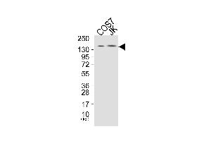 Western blot analysis of extracts from COS7 cells (Lane 1), and JK cells (Lane 2), using PLCG1 (Ab-771) Antibody.