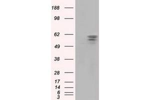 Image no. 2 for anti-Pantothenate Kinase 2 (PANK2) antibody (ABIN1500026) (PANK2 抗体)
