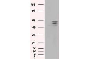 Image no. 2 for anti-Pantothenate Kinase 2 (PANK2) antibody (ABIN1500026) (PANK2 抗体)