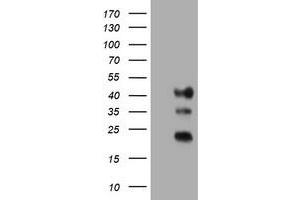Image no. 1 for anti-Transmembrane Protein 173 (TMEM173) antibody (ABIN1501425) (STING/TMEM173 抗体)