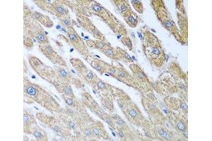 Immunohistochemistry of paraffin-embedded Human liver using FUT6 Polyclonal Antibody at dilution of 1:100 (40x lens). (FUT6 抗体)