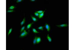 Immunofluorescence staining of Hela cells with ABIN7170782 at 1:66, counter-stained with DAPI. (SREBF2 抗体  (AA 75-164))