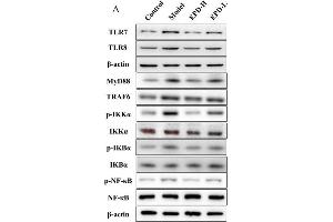 EPD suppressed the activation of the Toll-like receptor 7-myeloid differentiation primary response gene 88-nuclear factor-κB (TLR7/8-MyD88-NF-κB) signaling pathways. (NFKBIA 抗体  (AA 1-120))