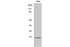Western Blotting (WB) image for anti-Superoxide Dismutase 1, Soluble (SOD1) antibody (ABIN5958576) (SOD1 抗体)