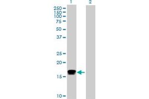 Western Blot analysis of IFNA2 expression in transfected 293T cell line by IFNA2 MaxPab polyclonal antibody. (IFNA2 抗体  (AA 1-188))
