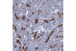 Immunohistochemical staining of human pancreas with C1orf86 polyclonal antibody  shows strong positivity in pancreatic ducts. (C1orf86 抗体)
