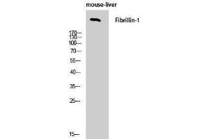 Western Blotting (WB) image for anti-Fibrillin 1 (FBN1) (C-Term) antibody (ABIN3175065) (Fibrillin 1 抗体  (C-Term))