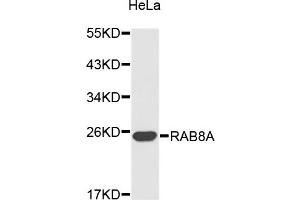 Western blot analysis of extracts of HeLa cells, using RAB8A antibody.