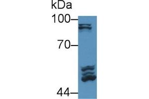 Detection of POSTN in Rat Serum using Polyclonal Antibody to Periostin (POSTN) (Periostin 抗体  (AA 24-173))