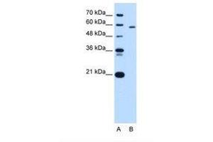 Image no. 2 for anti-Pyruvate Kinase, Liver and RBC (PKLR) (AA 56-105) antibody (ABIN320669) (PKLR 抗体  (AA 56-105))