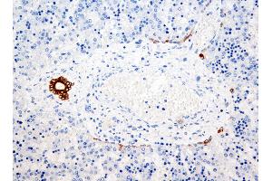 Immunohistochemistry (IHC) image for anti-Keratin 7/17/19 (KRT7/17/19) antibody (ABIN108432) (Keratin 7/17/19 抗体)