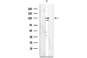 anti-Retinoblastoma Protein (Rb Protein) (Internal Region) antibody