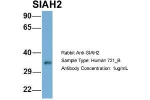 Host: Rabbit Target Name: SIAH2 Sample Type: 721_B Antibody Dilution: 1. (SIAH2 抗体  (Middle Region))