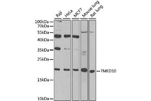 Western blot analysis of extracts of various cell lines, using TMED10 antibody. (TMED10 抗体)
