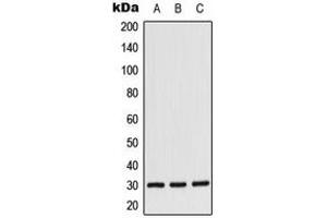 Western blot analysis of CK1 alpha expression in Jurkat (A), K562 (B), NIH3T3 (C) whole cell lysates.