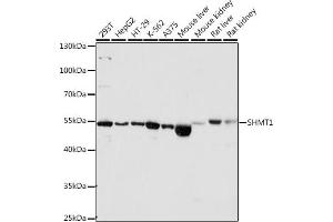 Western blot analysis of extracts of Mouse liver, using SHMT1 antibody (ABIN6132654, ABIN6147744, ABIN6147746 and ABIN6216135) at 1:1560 dilution. (SHMT1 抗体  (AA 285-444))