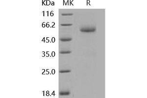 Western Blotting (WB) image for Bone Morphogenetic Protein Receptor 1A (BMPR1A) (Active) protein (His tag,Fc Tag) (ABIN7320450)